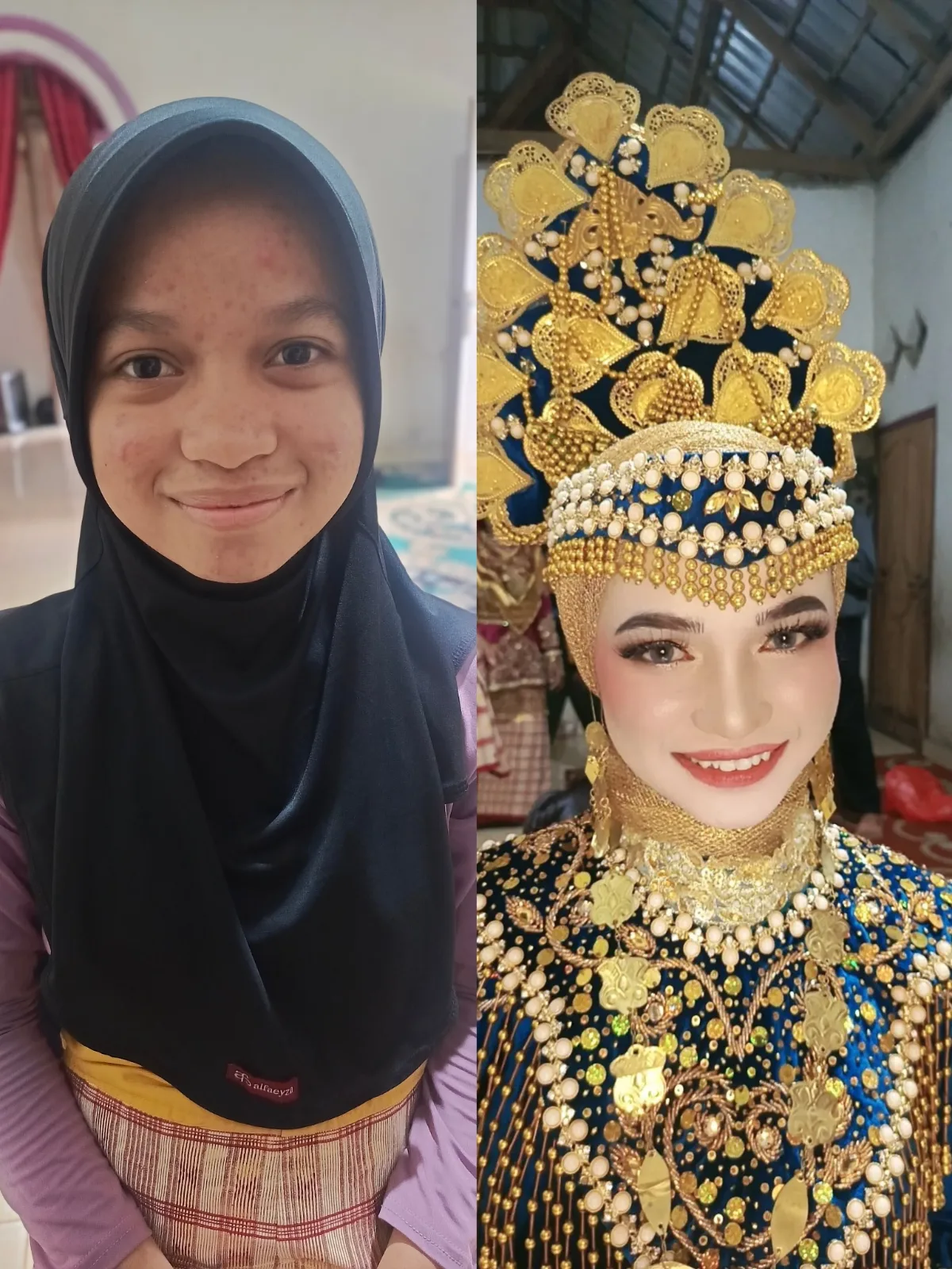 Before After