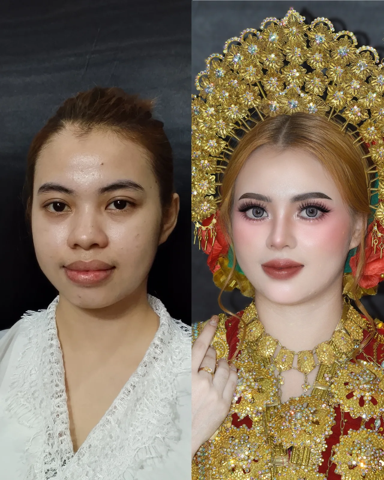 Before After